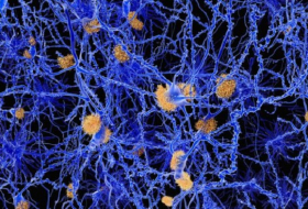 Molecule clears Alzheimer`s plaques in mice